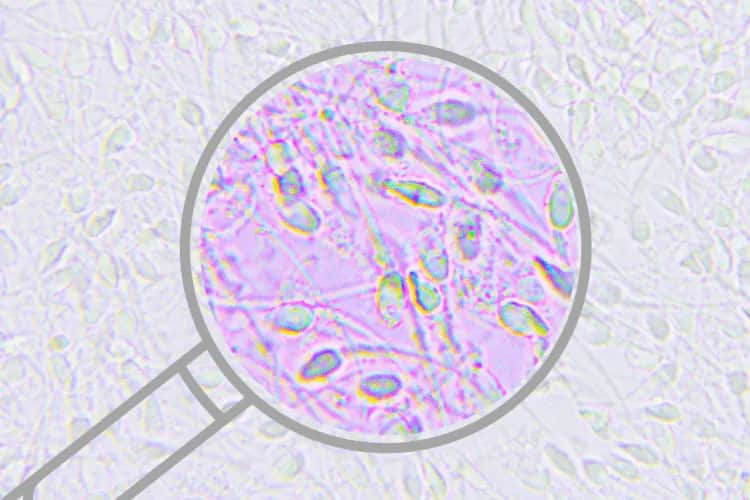 Czy badanie nasienia to grzech? Moralne dylematy i nauka Kościoła