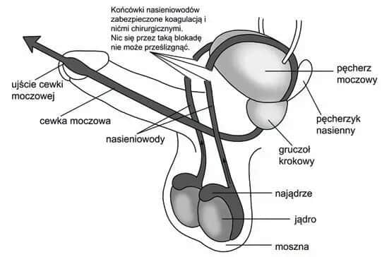 Czy wazektomia to grzech? Odkryj moralne dylematy w Kościele katolickim